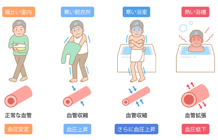ヒートショックの危険性